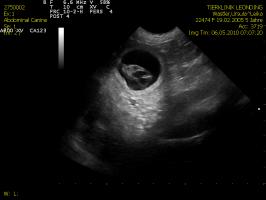 Wastler Leika - Ultraschall Uterus.jpg